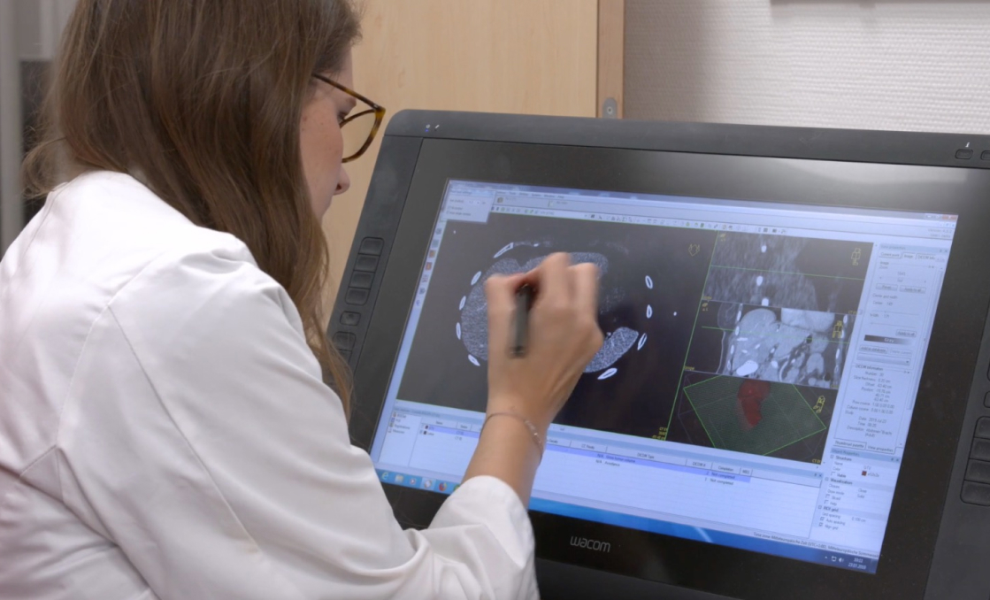 Webinar liver brachytherapy new strategies 3x